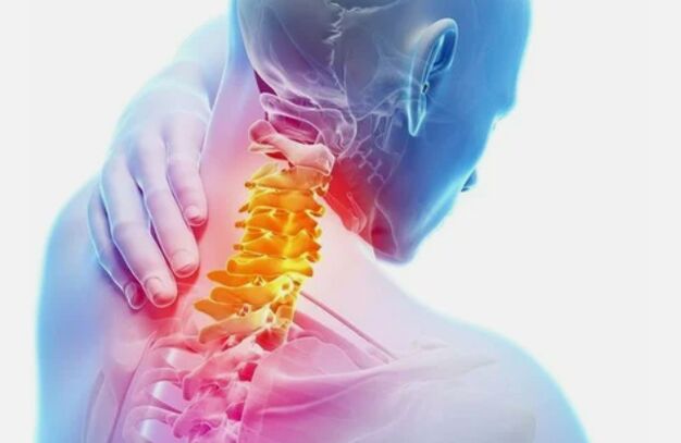 Osteochondróza krčnej oblasti