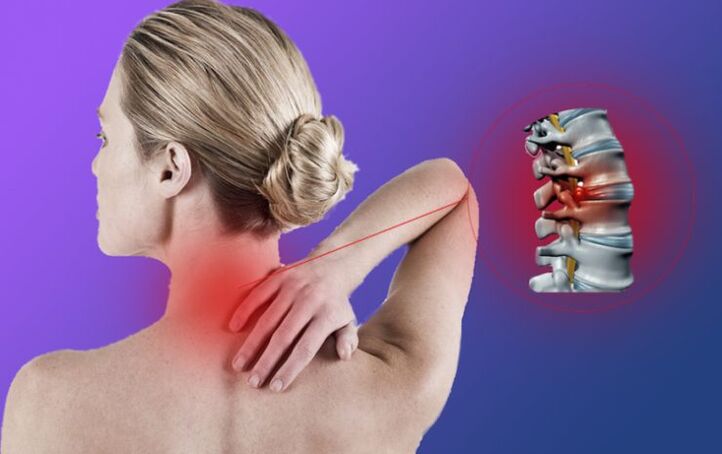 Zápal chrbtice s krčnej osteochondrózy