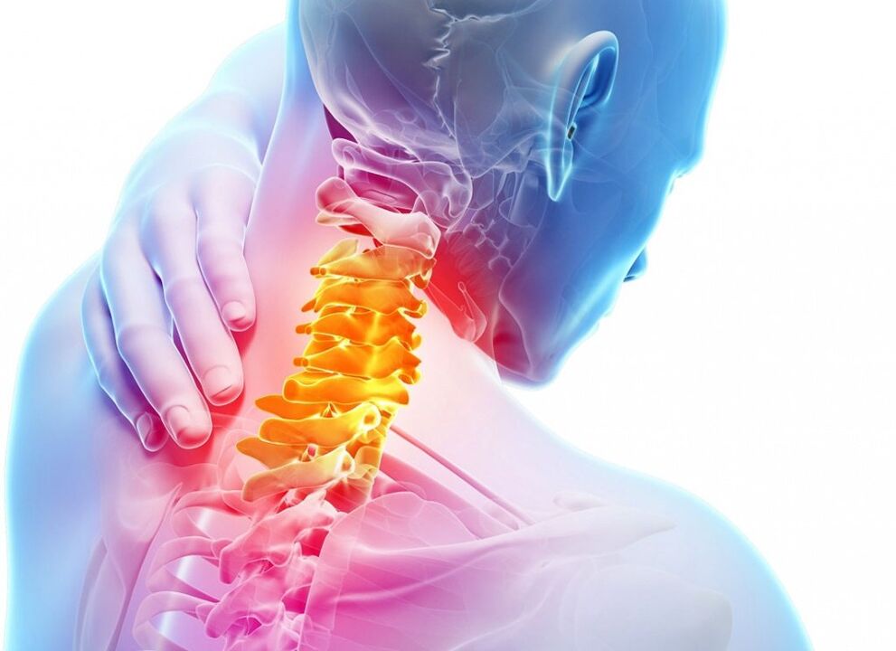 Čo je cervikálna osteochondróza