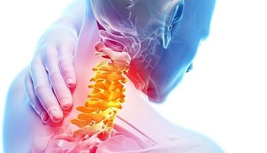 príčiny krčnej osteochondrózy