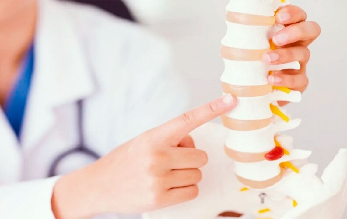 poškodenie chrbtice v dôsledku cervikálnej osteochondrózy