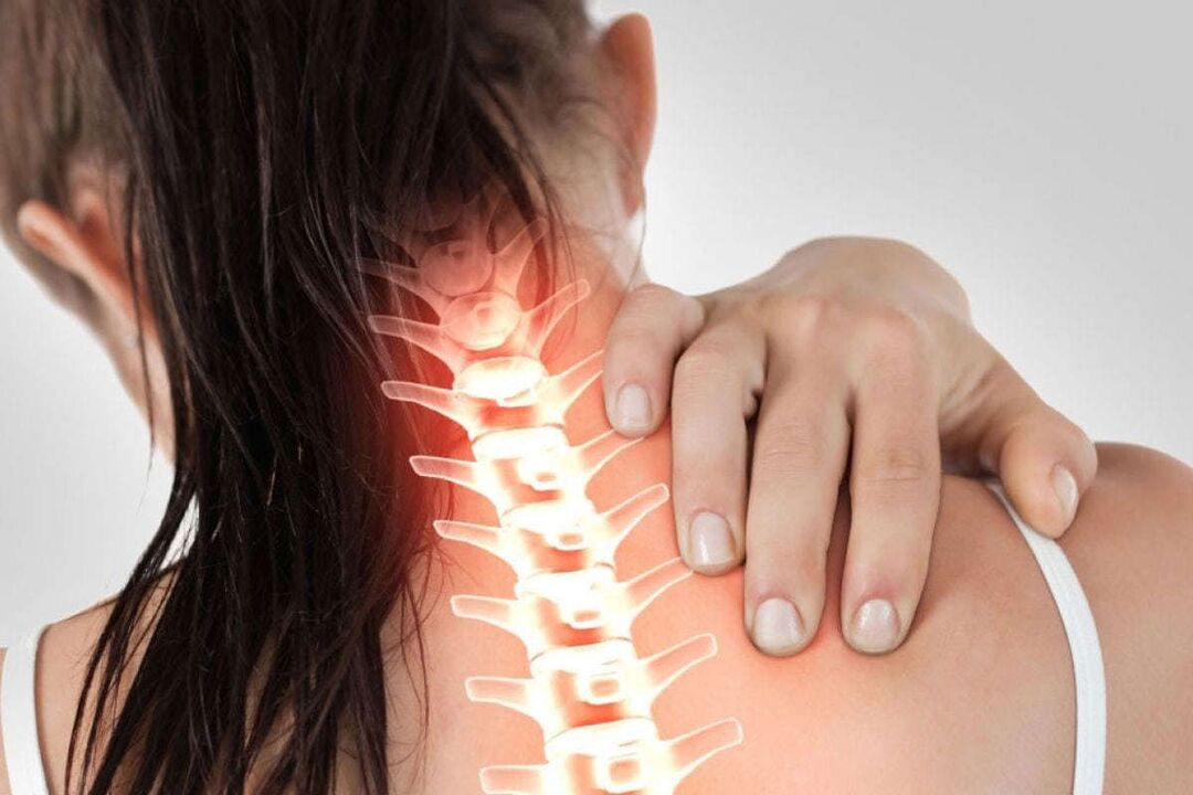 prejavy krčnej osteochondrózy